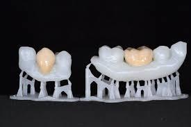 3D printed teeth in a reference model.