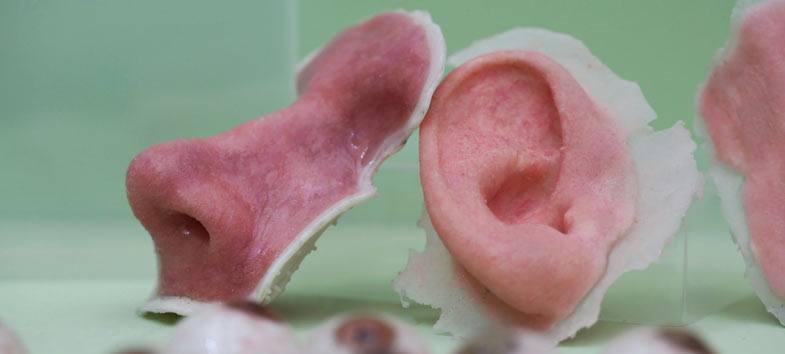 Nose and ear 3D printed from live tissue.