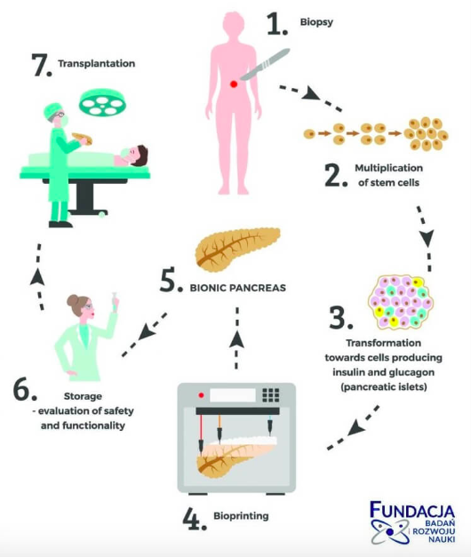 bionic pancreas