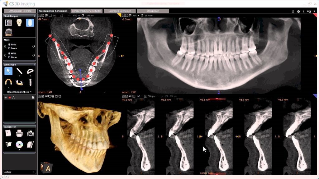 An example CBCT scan.