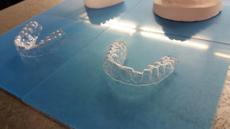 Aligners made by designer student Amos Dudley