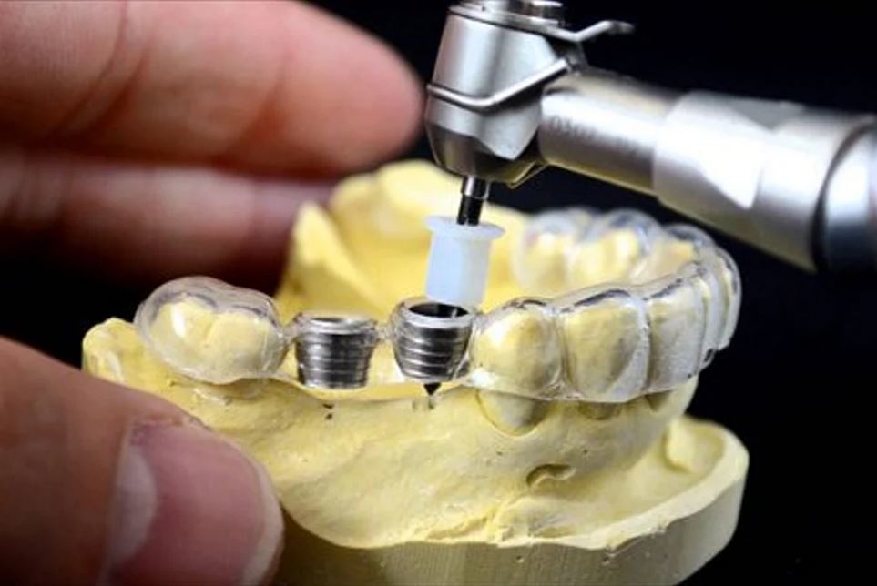 An accessory for dental surgery