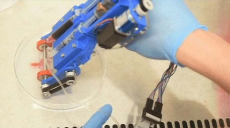 The University of Toronto's handheld Bioprinter prints strips of human skin