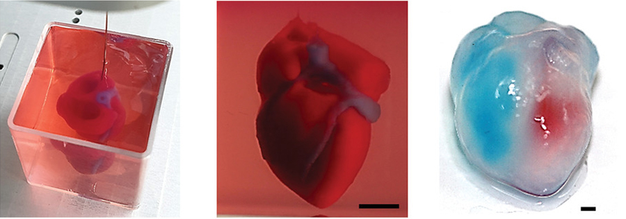 The first fully-vascularized 3D printed human heart
