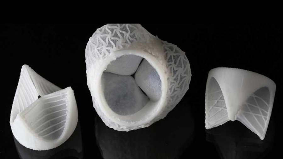 The artificial 3D printed heart valves that can replace leaking or damaged valves in real patients.