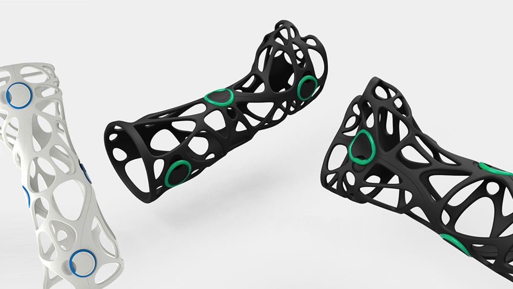 Image of 3D Print Orthotics, Braces & Casts: Xkelet
