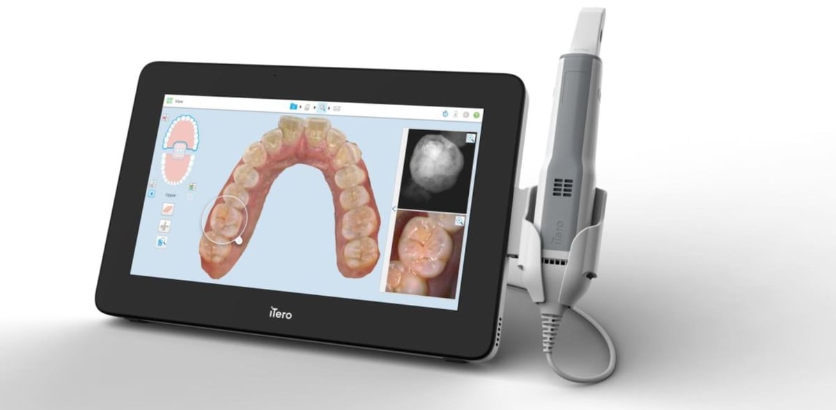 Image of The Best Intraoral Scanners / Dental Scanners: iTero Element 5D+ Mobile