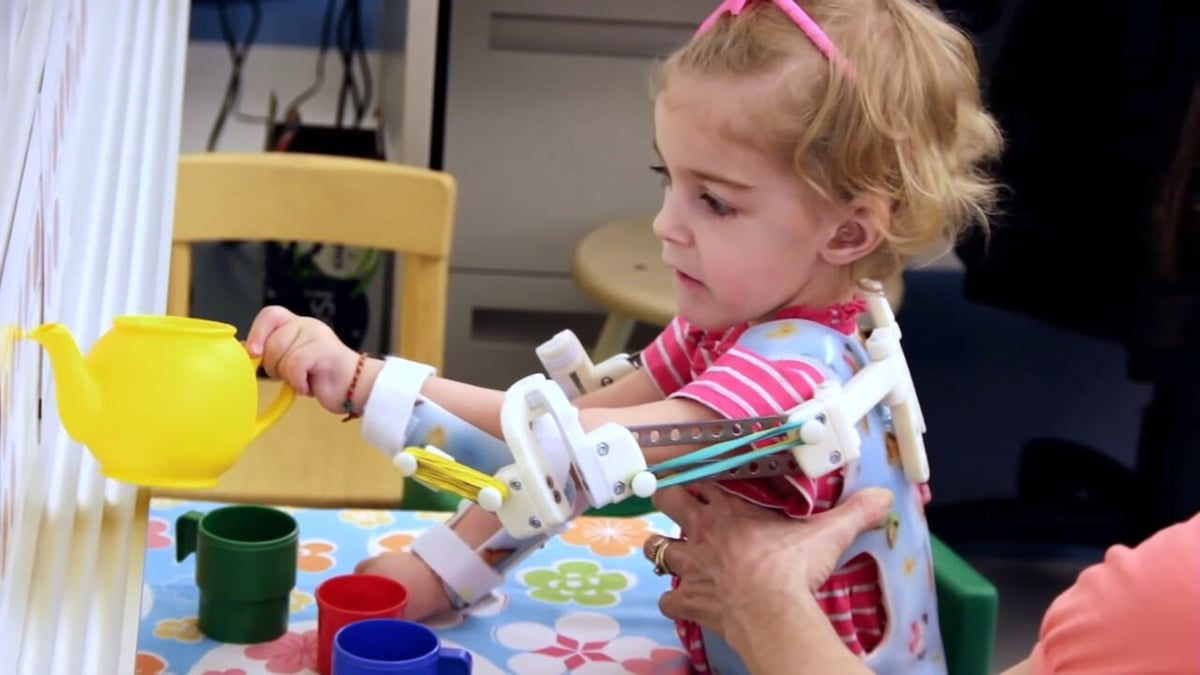 3D printed WREX lets children regain their arm mobility