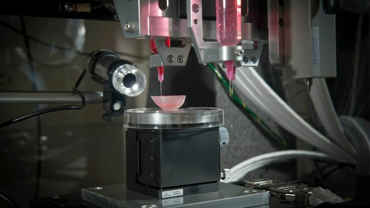 Kidneys, needed transplant organs, are great bioprinting candidates