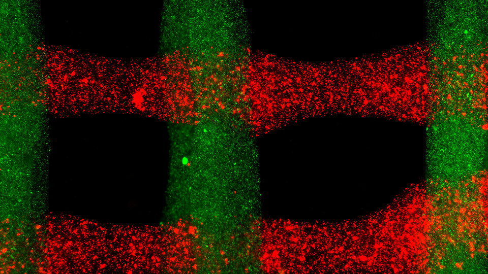 Printable Body Tissue with Personalized Bio-Inks Boost Healing ...