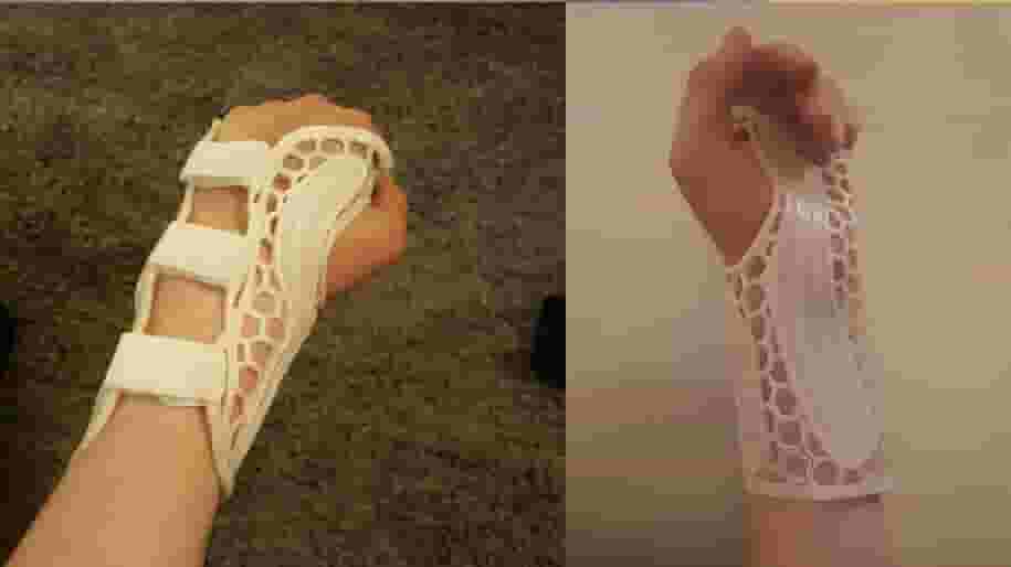 Featured image of How to 3D Print a Lightweight Wrist Brace