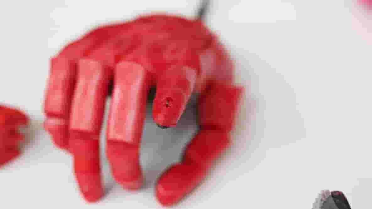 Featured image of Open Bionics Begins World First Bionic Hand Trial in Bristol