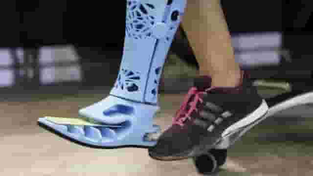 Featured image of This is the First 3D Printed Prosthetic Leg in the UAE