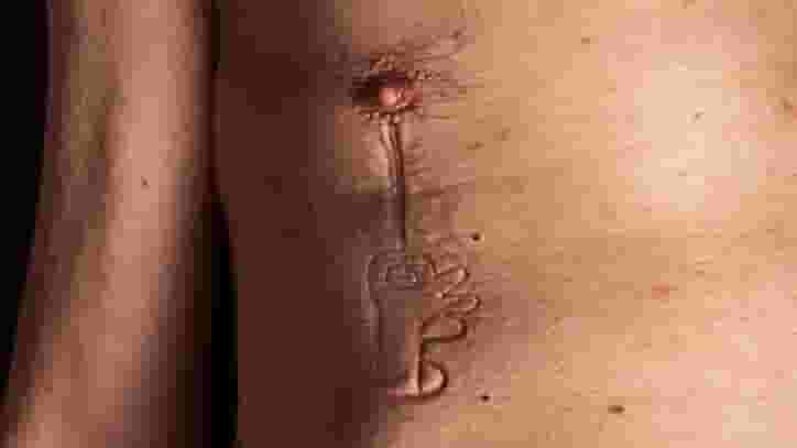 Featured image of “Hey Pressto” Project Turns Skin Into Stop Motion Animation With 3D Printed Stamps