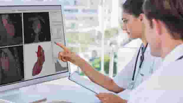 Featured image of Materialise and Henry Ford Health Systems Are Testing 3D Modeling in Procedural Planning