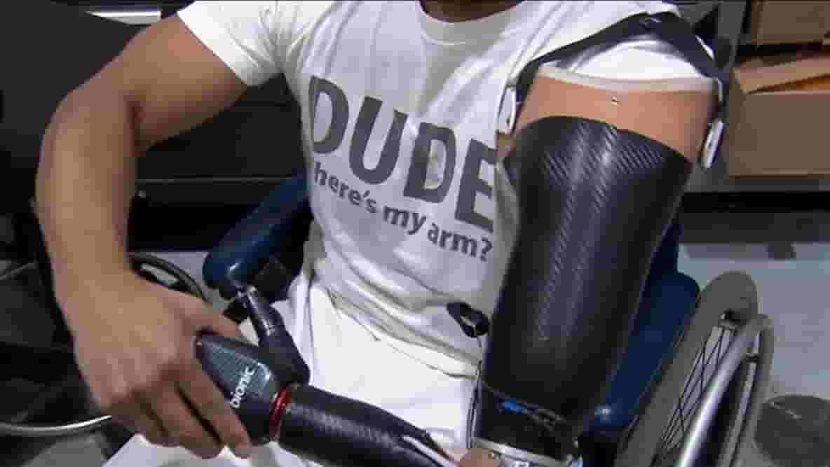 Featured image of Honda Employees 3D Print Prosthetic Arm for Colleague