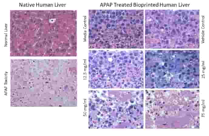 Featured image of Organovo Gets Orphan Drug Designation for 3D Printed Liver Tissue