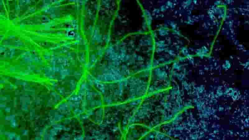 Featured image of DIY Fluorescence Microscope uses 3D Printed Parts and Smartphone Camera