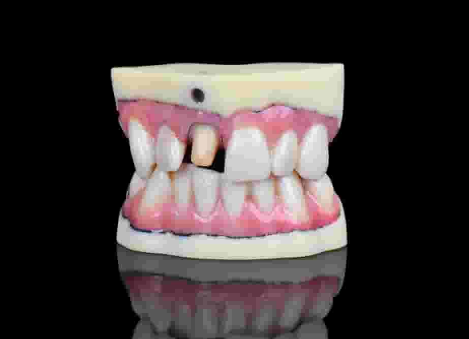 Featured image of Stratasys Unveils High Resolution J720 Dental 3D Printer