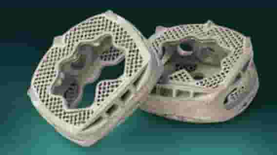 Featured image of Additive Implants’ 3D Printed SureMAX Cervical Spacer Cleared by FDA