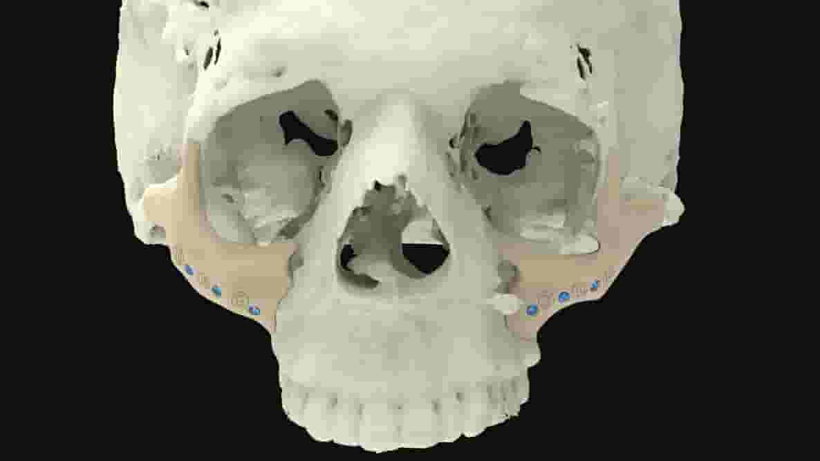 Featured image of 3D Printed Bones: The Most Jaw-Dropping Projects