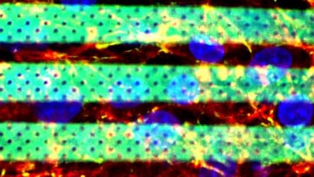 Featured image of Researchers 3D Print Accurate Microfluidic Model of the Blood-Brain Barrier