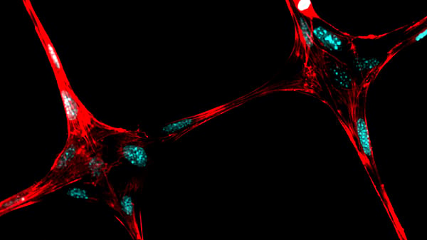 Featured image of Researchers Find New Low-Cost Ways to 3D Print Living Tissues and Organs