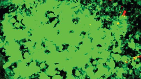 Featured image of Researchers 3D Bio-Print in Vitro Model to Study Cancer Drugs and Treatments