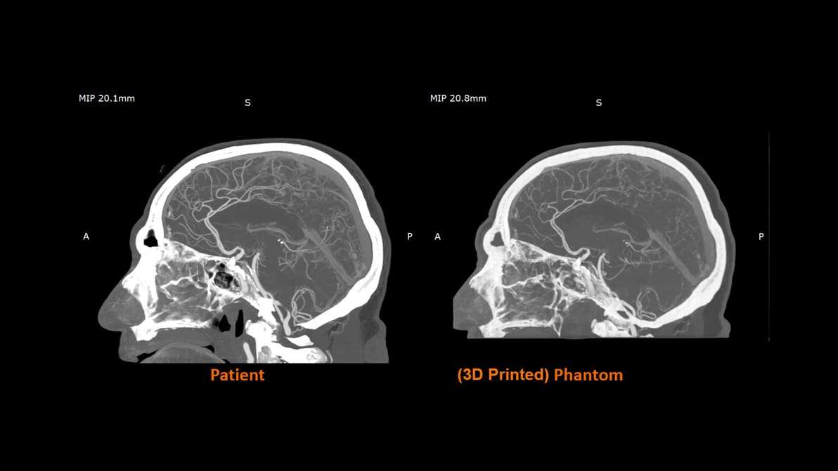 Imagem de destaque Stratasys desenvolve material 3D pioneiro que imita tecido humano em exames médicos