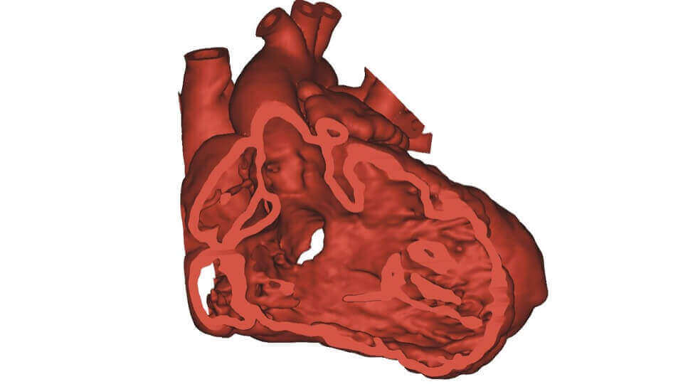 Featured image of Surgeons 3d-print heart to save a childs life
