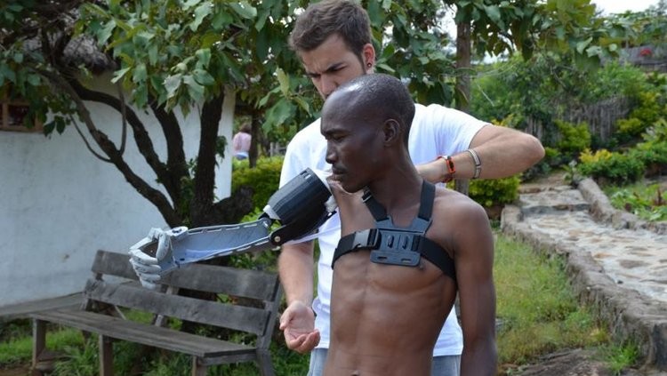 Featured image of 24-Year-Old Engineer is 3D Printing Prosthetics for People in Poor Countries