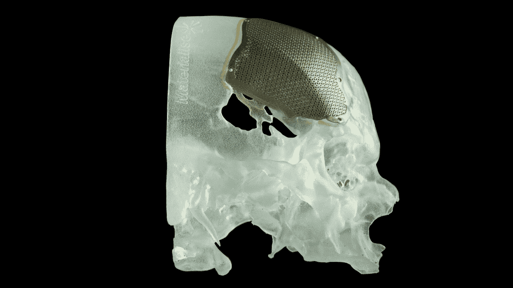 Revolutionizing Facial Reconstructive Surgery with 3D Printing | All3DP