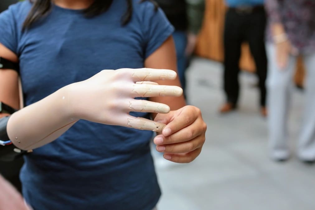 Featured image of Stratasys & Dassault Systèmes&nbsp;Partner to Develop Low-Cost 3D Printed Prosthetics
