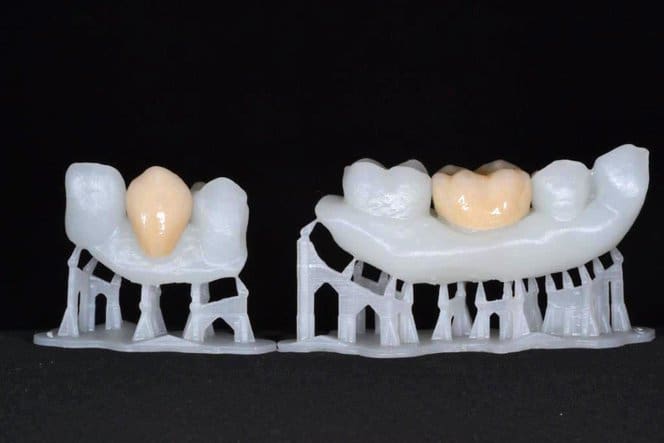 Dental models printed in resin.