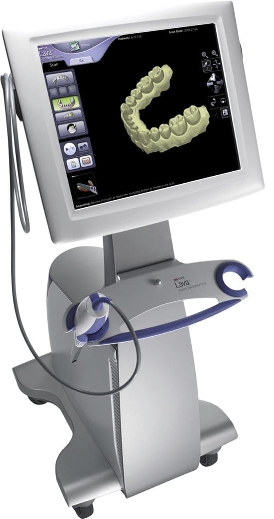 A chairside oral scanner.