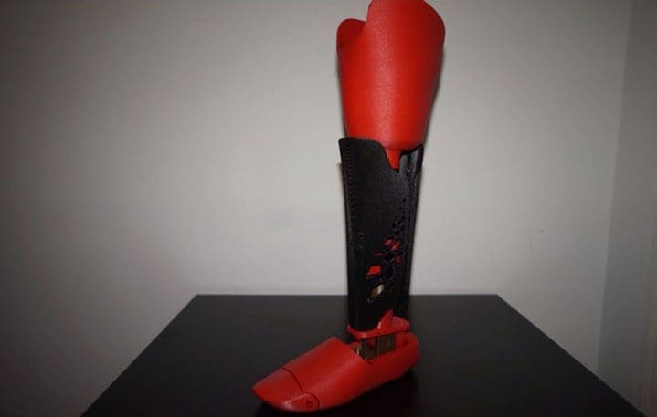 A prosthetic leg you can make 3D print at home