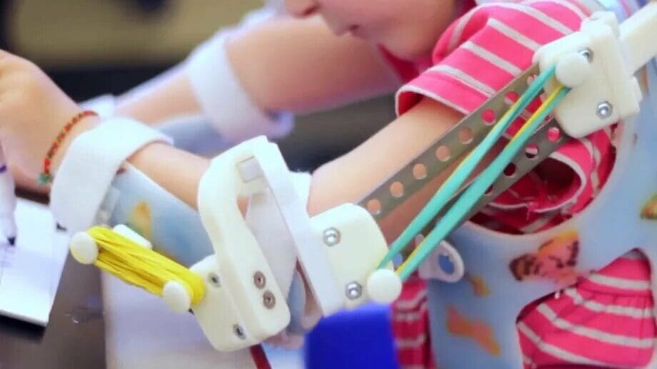 This exosqueleton has already changed the lives of 15 children