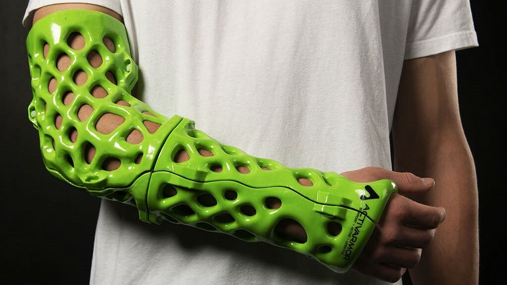 The only downside is your friends will no longer be able to sign your cast