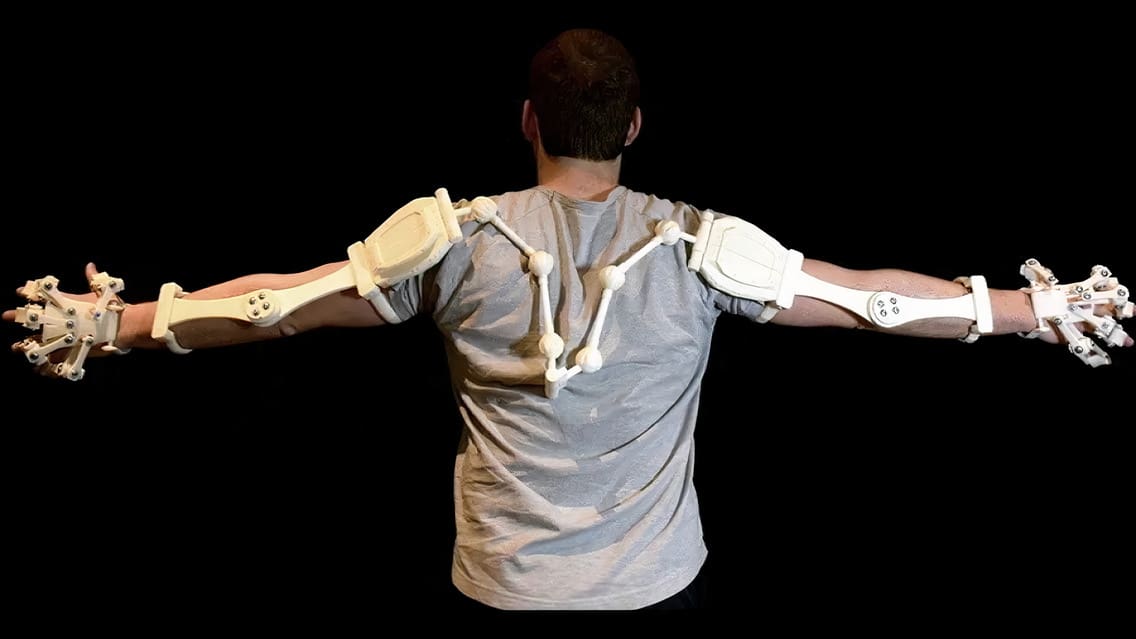 This exoskeleton has been growing one limb at a time