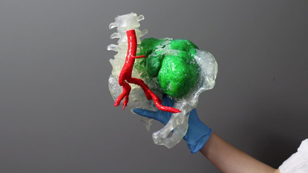 Image of 10 Most Innovative 3D Printing Companies: Axial3D