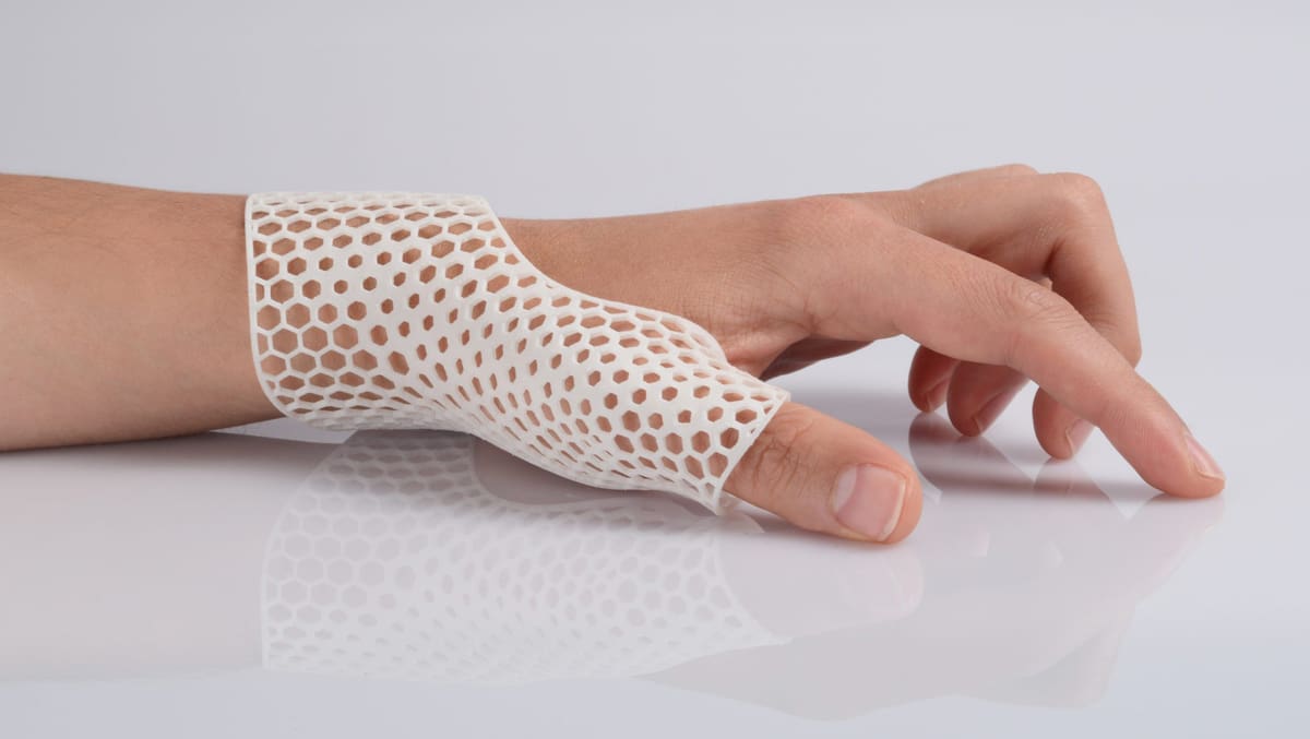 Image of When Does 3D Printing Outperform Injection Molding?: Mass Customization