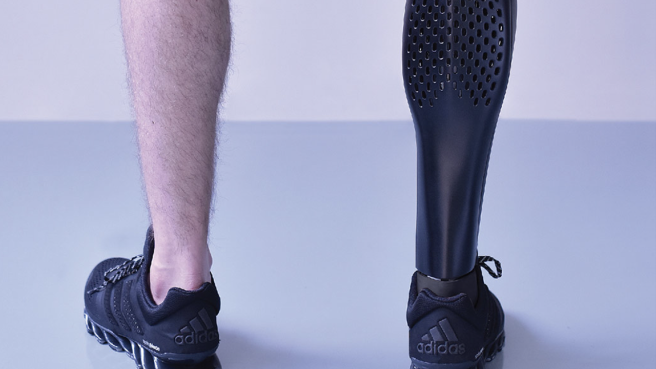 3D Printed Prosthetic 5 Promising Projects All3DP