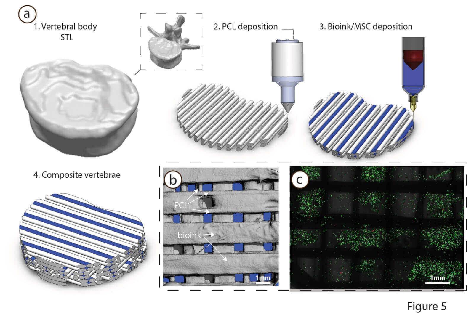 3D Printing Medical Breakthrough  . Breakthrough Technology Means Breakthrough Profits.