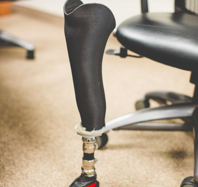 Thermoplastic Carbon Fiber 3d Printed Prosthetic Sockets May Be Strongest Yet All3dp