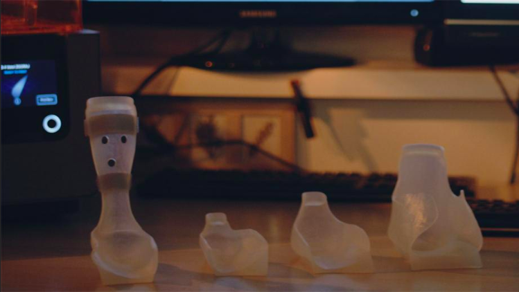 Father 3D Prints Orthoses for his Son, Now Helps Others | All3DP