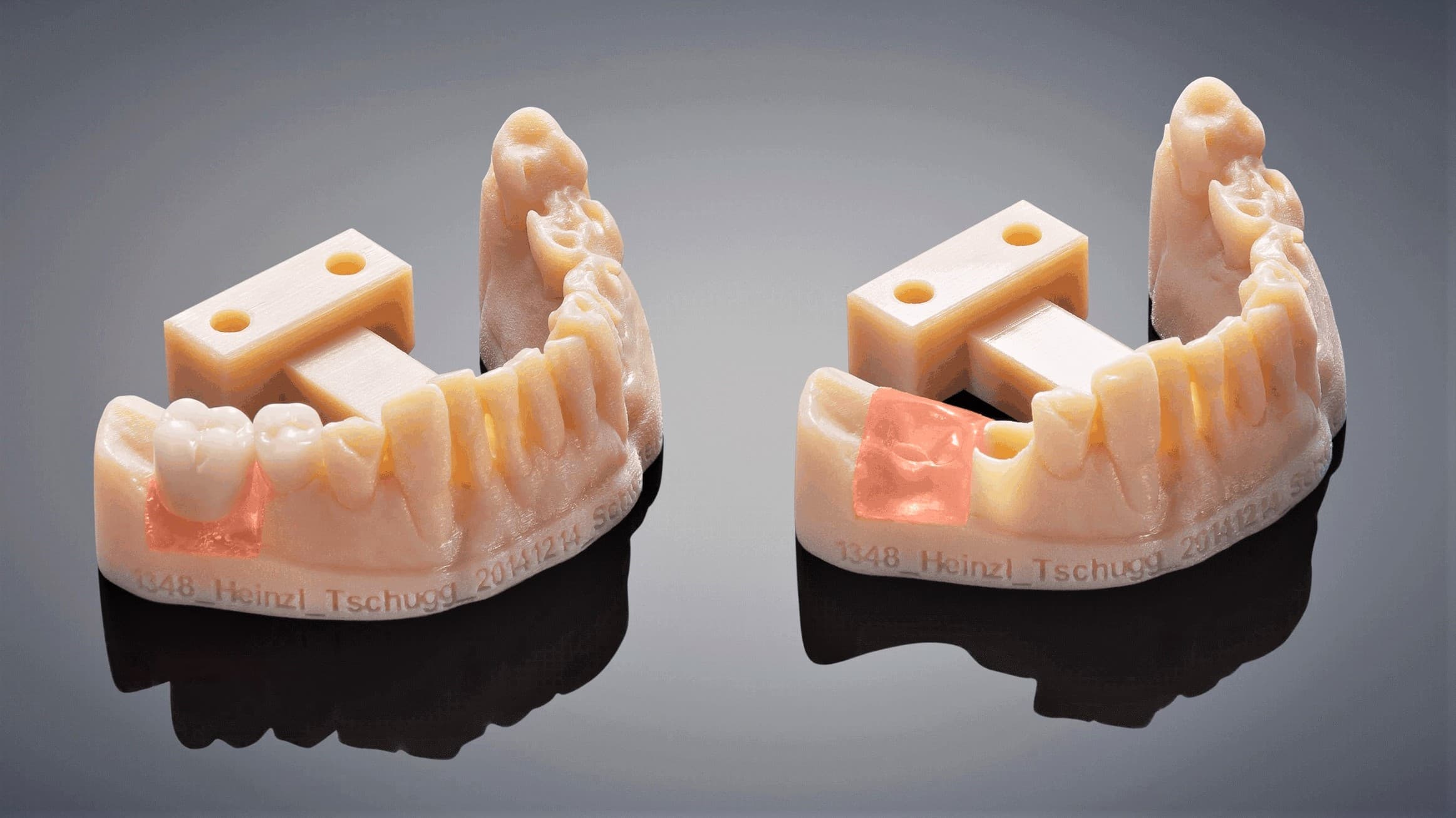 2021 Dental 3D Printing Guide All You Need to Know All3DP